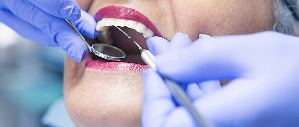 Best Walk-In Emergency Dental Services in Manson, WA